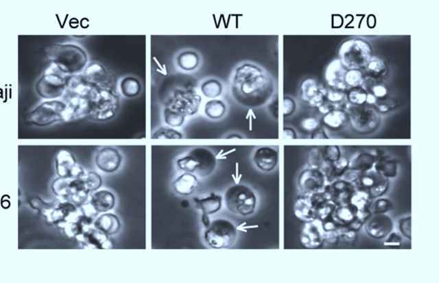 肿瘤细胞有两种“死法”，中国科学家详解决定因子