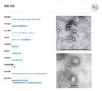 独家| 新型冠状病毒“通缉照”，你看懂了吗？