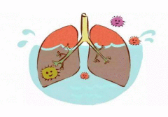 青海2月17日疫情最新消息：西宁累计确诊了几例