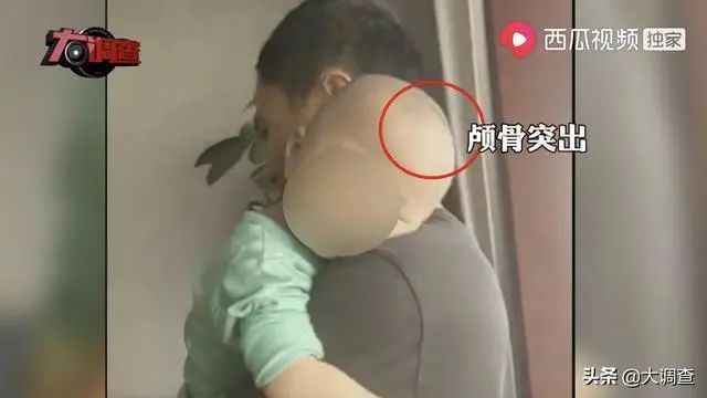 湖南“大头娃娃”事件持续发酵，家长买奶粉该如何避坑？